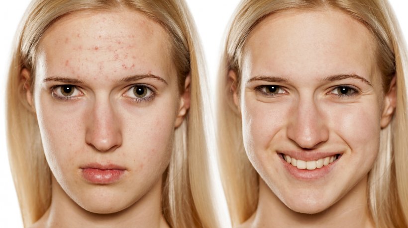Women Aesthetics